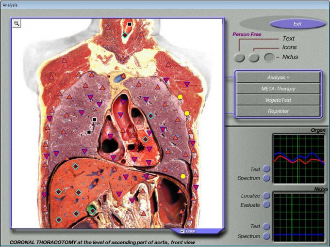 English Language Medical 3d Mra Body Tester Health Analyzer