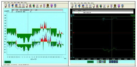 handheld NIBP / SPO2 24 Hours Ambulatorial Digital Blood Pressure Monitor