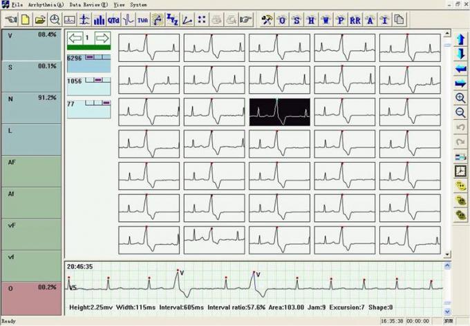 TLC6000 Dynamic ECG Systems 12 Lead ECG Holter Systems 48 Hours Recorder with Analysis Software