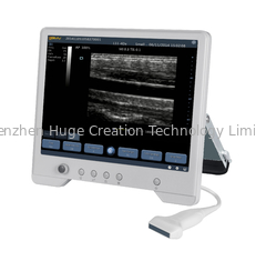 China TS20 Digital Diagnostic Ultrasound System for Obstetrics and Gynecology Department supplier