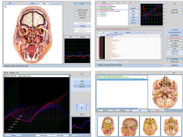 Original 9d Cell nls Full Body Health Analyzer 9d-nls With Russian/English Software supplier