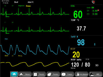 E12 Multi Parameter Oscillometry Modular Patient Monitor , 12 Inch TFT Display supplier