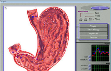 3d Mra / 3d Nls Quantum Resonance Health Analyzer Machine supplier