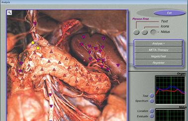 3d Mra / 3d Nls Quantum Resonance Health Analyzer Machine supplier