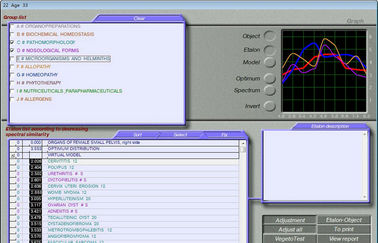 3d Mra / 3d Nls Quantum Resonance Health Analyzer Machine supplier