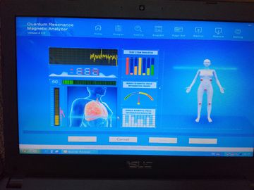 French Quantum Body Health Analyzer supplier