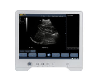 TS20 Digital Diagnostic Ultrasound System for Obstetrics and Gynecology Department supplier