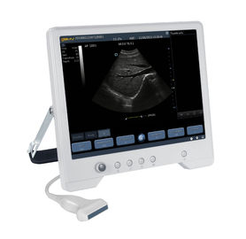 TS20 Digital Diagnostic Ultrasound System for Obstetrics and Gynecology Department supplier