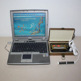 Mini size bronze color Body Composition Analyzer AH - Q12 with 41 reports supplier