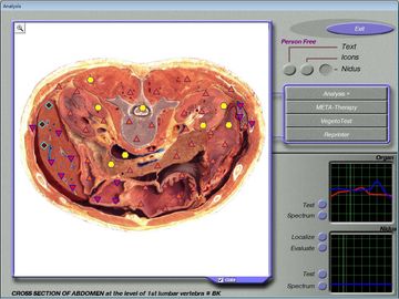 3d Nls Health Analyzer , Body Scanner For Health Examination Centre supplier