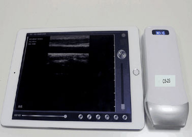 Portable Ultrasonic Diagnostic Devices Type wireless ultrasound with convex probe supplier