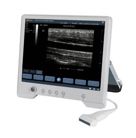 China TS20 Digital Diagnostic Ultrasound System for Obstetrics and Gynecology Department distributor