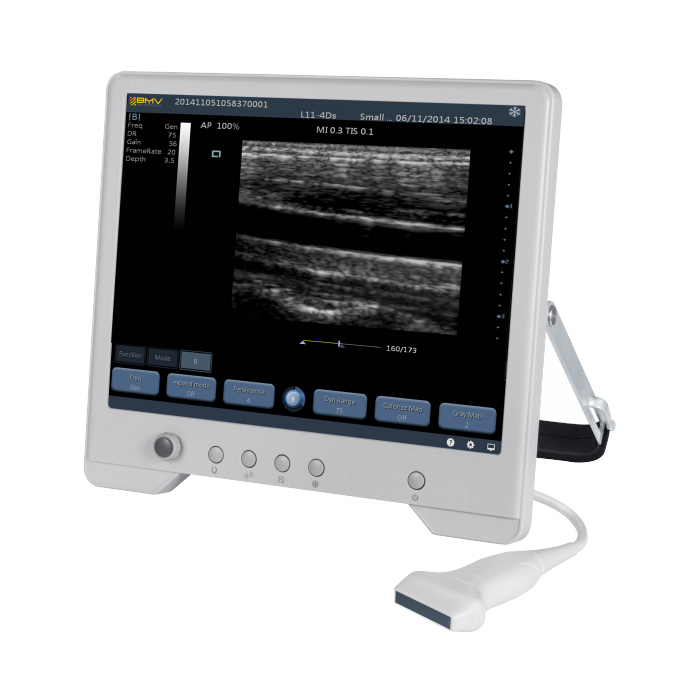 TS20 Digital Diagnostic Ultrasound System for Obstetrics and Gynecology Department