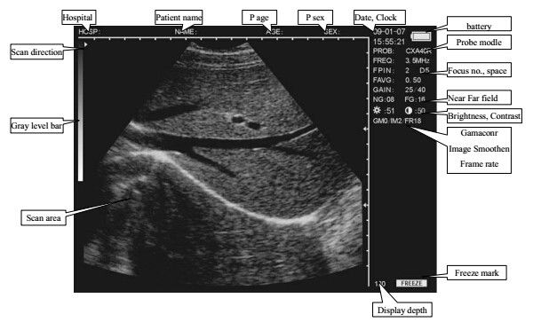 CLS5800 laptop Veterinary Ultrasound Scanner Full Digital Ultrasonic Diagnostic System